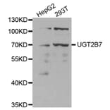 Western blot - UGT2B7 Antibody from Signalway Antibody (32390) - Antibodies.com