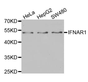 Western blot - IFNAR1 Antibody from Signalway Antibody (32400) - Antibodies.com