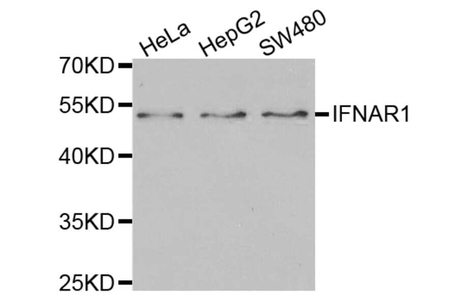 Western blot - IFNAR1 Antibody from Signalway Antibody (32400) - Antibodies.com