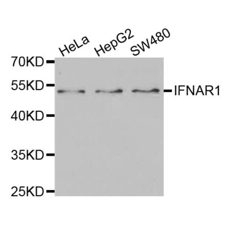 Western blot - IFNAR1 Antibody from Signalway Antibody (32400) - Antibodies.com