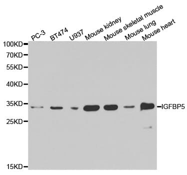 Western blot analysis of extracts of various cell lines, using IGFBP5 antibody.