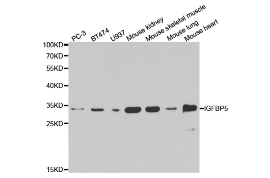 Western blot - IGFBP5 Antibody from Signalway Antibody (32403) - Antibodies.com