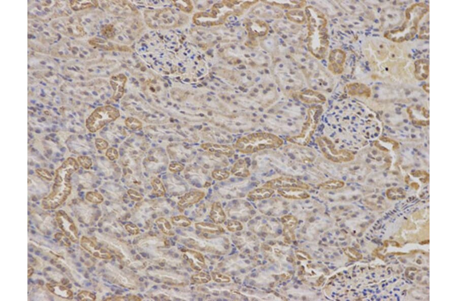 Immunohistochemistry - IGFBP5 Antibody from Signalway Antibody (32403) - Antibodies.com