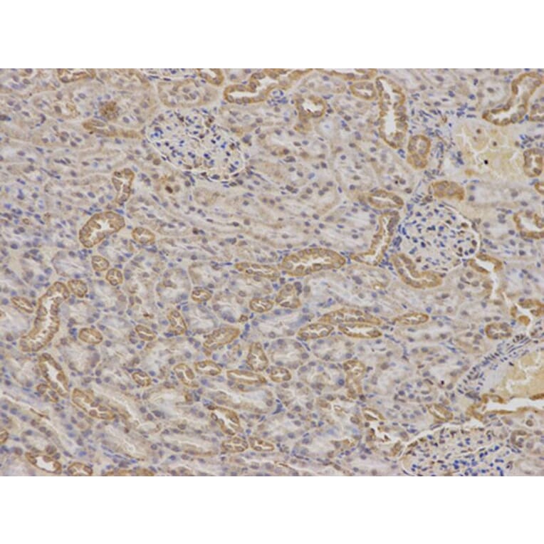 Immunohistochemistry - IGFBP5 Antibody from Signalway Antibody (32403) - Antibodies.com