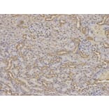 Immunohistochemistry - IGFBP5 Antibody from Signalway Antibody (32403) - Antibodies.com