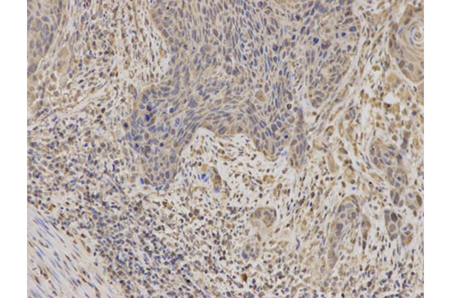 Immunohistochemistry - IGFBP5 Antibody from Signalway Antibody (32403) - Antibodies.com