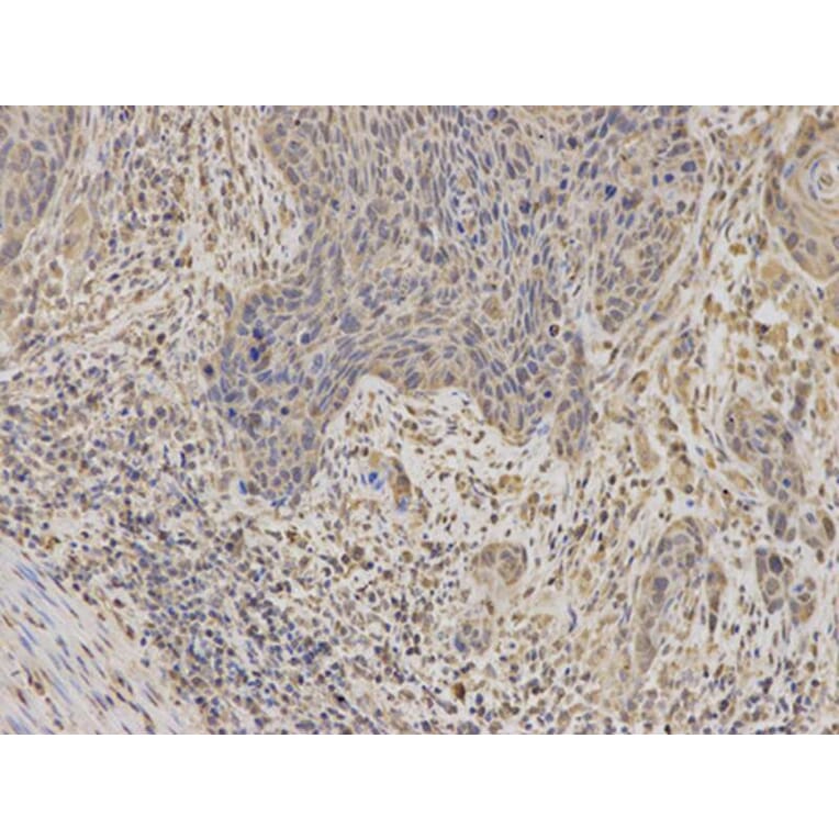 Immunohistochemistry - IGFBP5 Antibody from Signalway Antibody (32403) - Antibodies.com