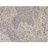 Immunohistochemistry - IGFBP5 Antibody from Signalway Antibody (32403) - Antibodies.com