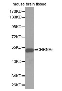 Western blot analysis of extracts of mouse brain tissue cell lines, using CHRNA5 antibody.