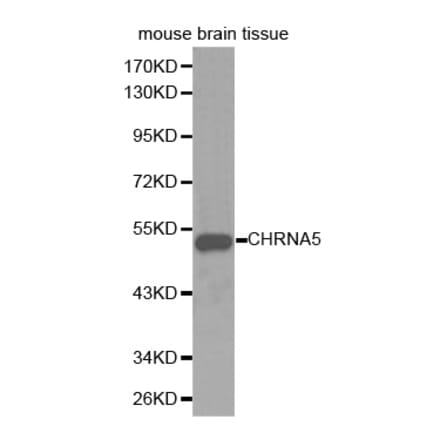 Western blot - CHRNA5 Antibody from Signalway Antibody (32409) - Antibodies.com