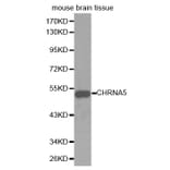 Western blot - CHRNA5 Antibody from Signalway Antibody (32409) - Antibodies.com