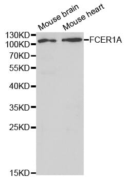 Western blot analysis of extracts of various cell lines, using FCER1A antibody.