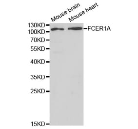 Western blot - FCER1A Antibody from Signalway Antibody (32415) - Antibodies.com