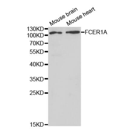 Western blot - FCER1A Antibody from Signalway Antibody (32415) - Antibodies.com