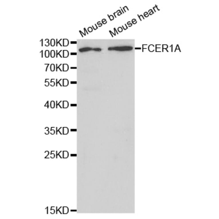 Western blot - FCER1A Antibody from Signalway Antibody (32415) - Antibodies.com