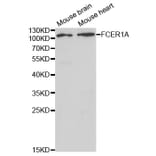 Western blot - FCER1A Antibody from Signalway Antibody (32415) - Antibodies.com