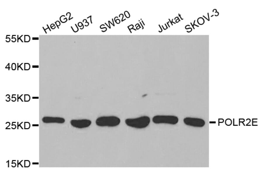 Western blot - POLR2E Antibody from Signalway Antibody (32417) - Antibodies.com