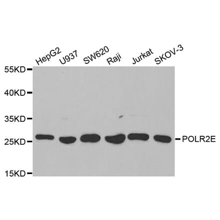 Western blot - POLR2E Antibody from Signalway Antibody (32417) - Antibodies.com