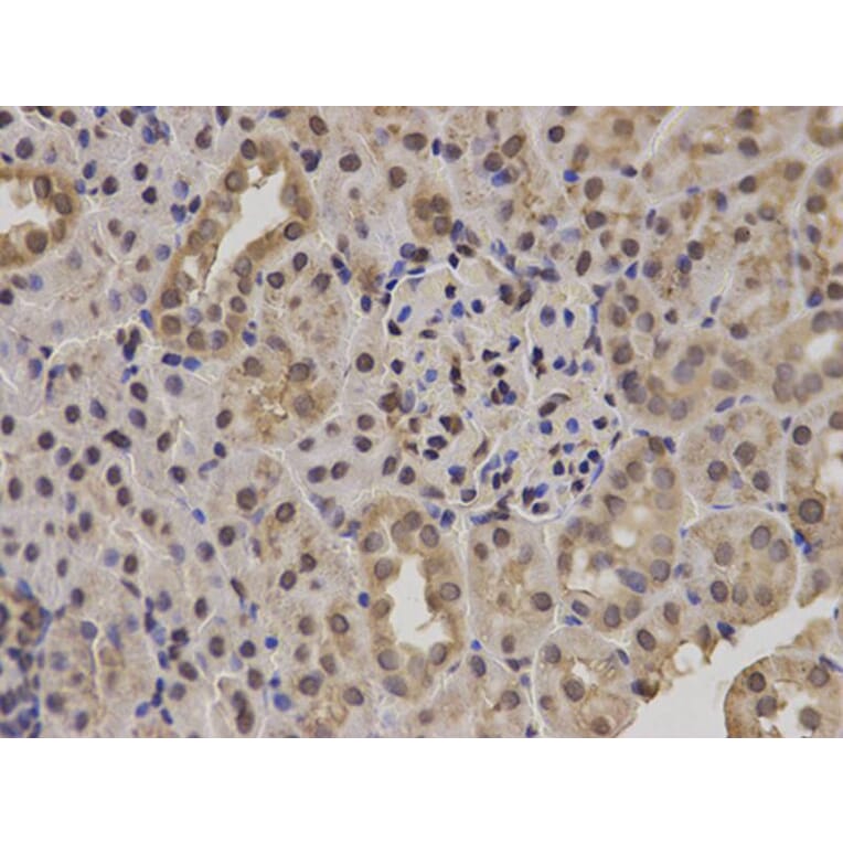 Immunohistochemistry - POLR2E Antibody from Signalway Antibody (32417) - Antibodies.com