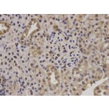 Immunohistochemistry - POLR2E Antibody from Signalway Antibody (32417) - Antibodies.com