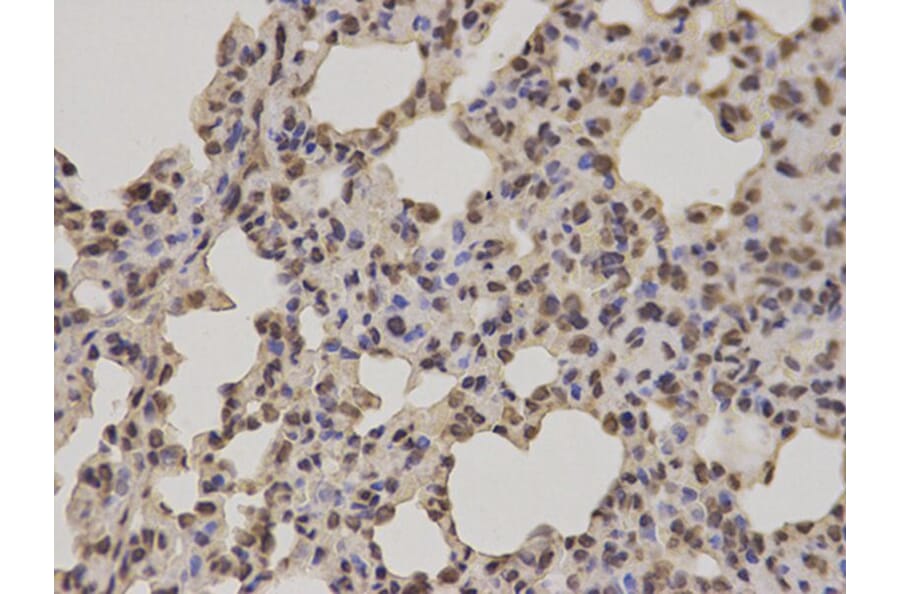 Immunohistochemistry - POLR2E Antibody from Signalway Antibody (32417) - Antibodies.com