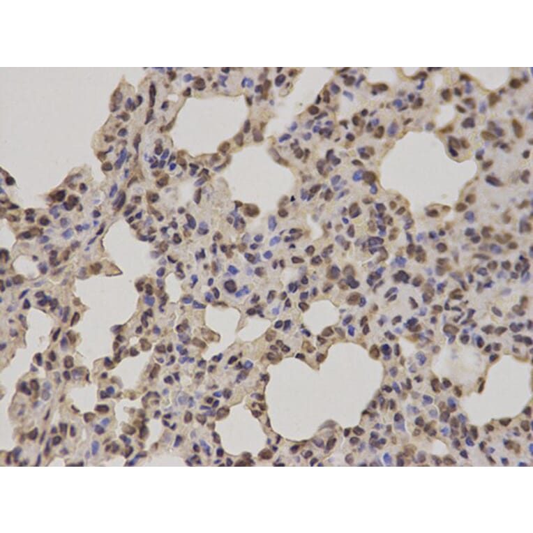 Immunohistochemistry - POLR2E Antibody from Signalway Antibody (32417) - Antibodies.com