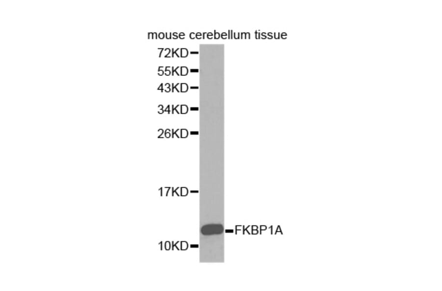 Western blot - FKBP1A Antibody from Signalway Antibody (32421) - Antibodies.com