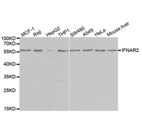 Western blot - IFNAR2 Antibody from Signalway Antibody (32426) - Antibodies.com