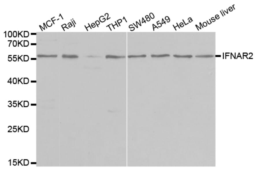 Western blot - IFNAR2 Antibody from Signalway Antibody (32426) - Antibodies.com
