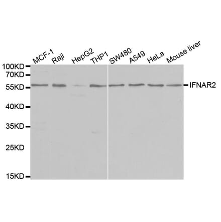 Western blot - IFNAR2 Antibody from Signalway Antibody (32426) - Antibodies.com