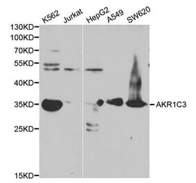 Western blot - AKR1C3 Antibody from Signalway Antibody (32432) - Antibodies.com