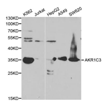 Western blot - AKR1C3 Antibody from Signalway Antibody (32432) - Antibodies.com
