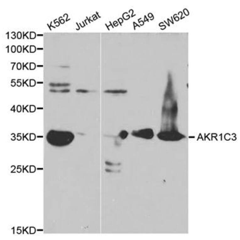 Western blot - AKR1C3 Antibody from Signalway Antibody (32432) - Antibodies.com
