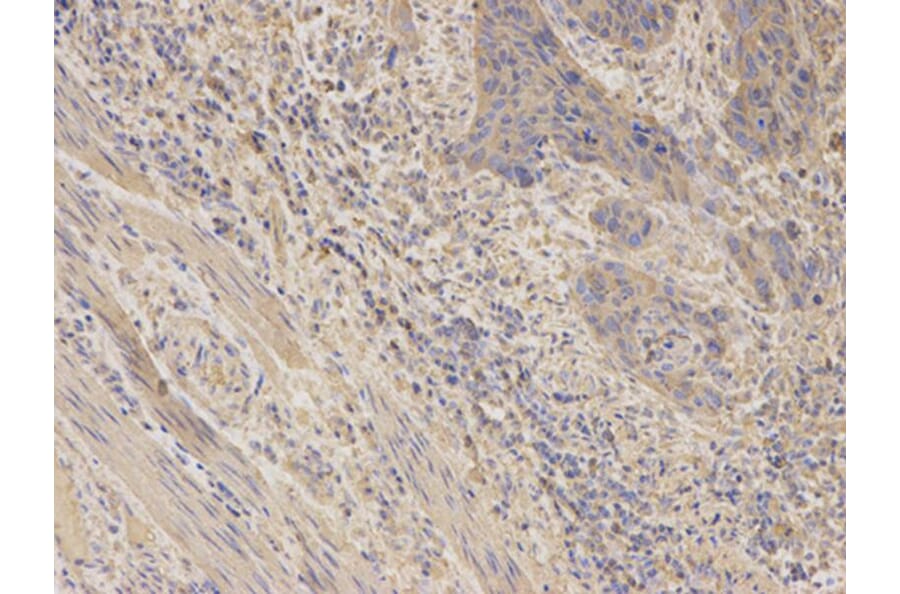 Immunohistochemistry - AKR1C3 Antibody from Signalway Antibody (32432) - Antibodies.com