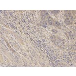 Immunohistochemistry - AKR1C3 Antibody from Signalway Antibody (32432) - Antibodies.com