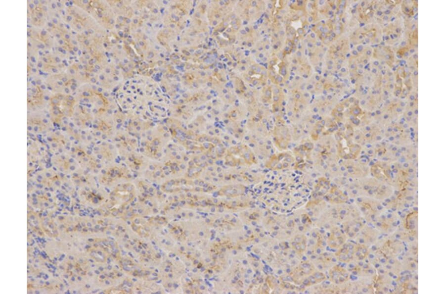 Immunohistochemistry - AKR1C3 Antibody from Signalway Antibody (32432) - Antibodies.com
