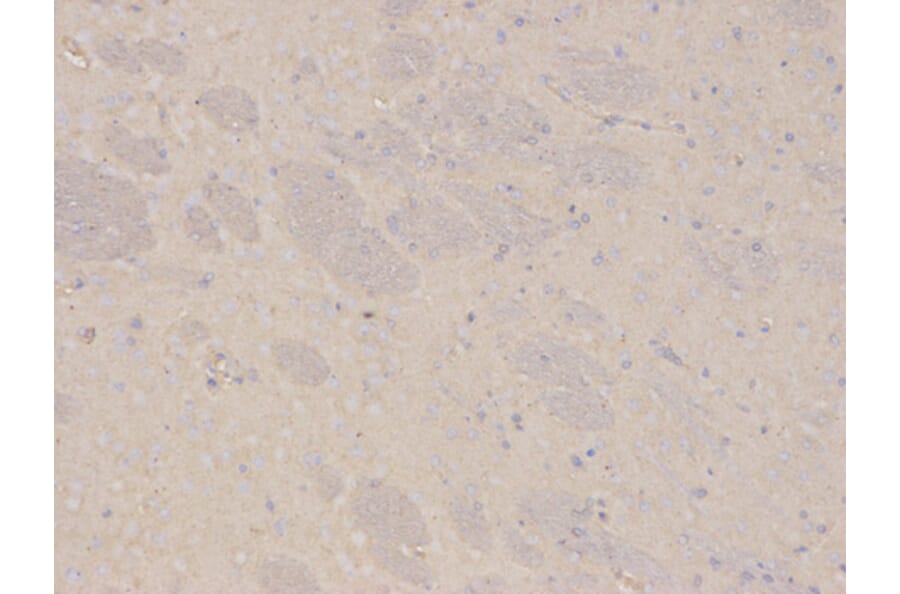 Immunohistochemistry - AKR1C3 Antibody from Signalway Antibody (32432) - Antibodies.com