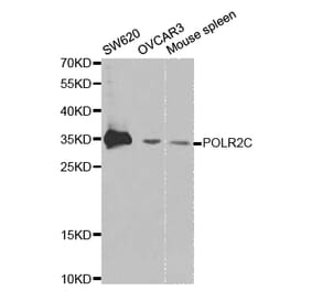 Western blot - POLR2C Antibody from Signalway Antibody (32435) - Antibodies.com