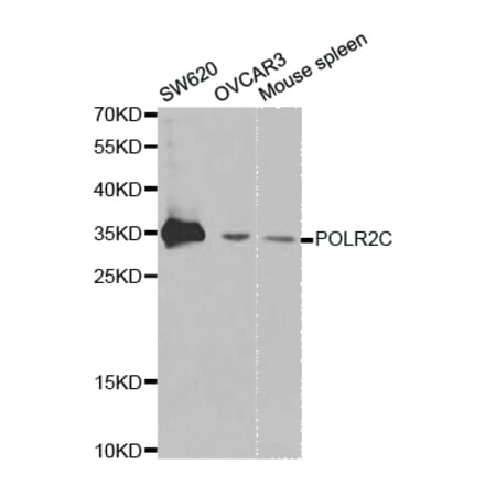 Western blot - POLR2C Antibody from Signalway Antibody (32435) - Antibodies.com