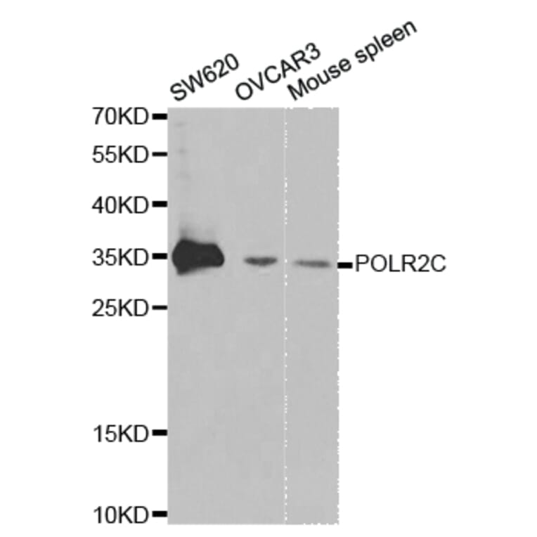 Western blot - POLR2C Antibody from Signalway Antibody (32435) - Antibodies.com