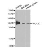 Western blot - POLR2C Antibody from Signalway Antibody (32435) - Antibodies.com