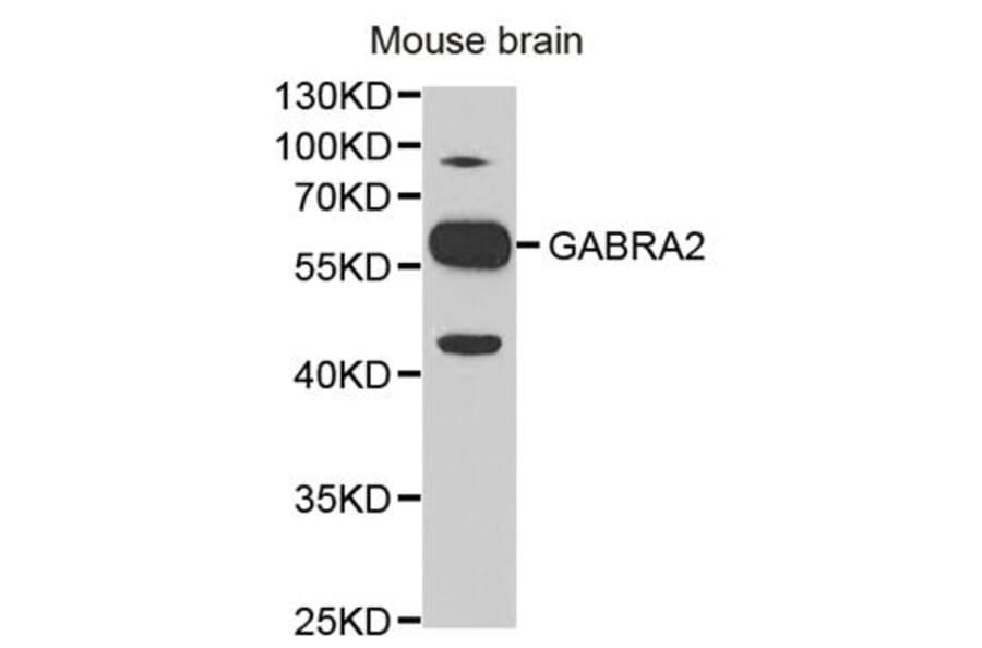 Western blot - GABRA2 Antibody from Signalway Antibody (32442) - Antibodies.com