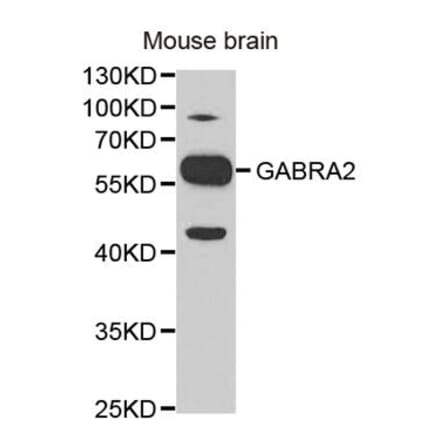 Western blot - GABRA2 Antibody from Signalway Antibody (32442) - Antibodies.com