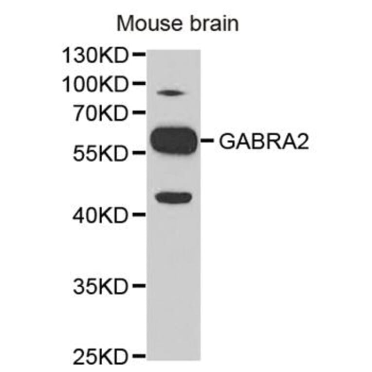 Western blot - GABRA2 Antibody from Signalway Antibody (32442) - Antibodies.com