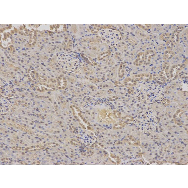 Immunohistochemistry - GABRA2 Antibody from Signalway Antibody (32442) - Antibodies.com