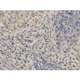 Immunohistochemistry - GABRA2 Antibody from Signalway Antibody (32442) - Antibodies.com