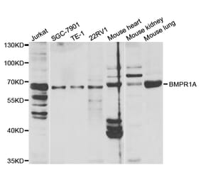 Western blot - BMPR1A Antibody from Signalway Antibody (32447) - Antibodies.com