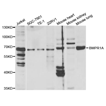 Western blot - BMPR1A Antibody from Signalway Antibody (32447) - Antibodies.com