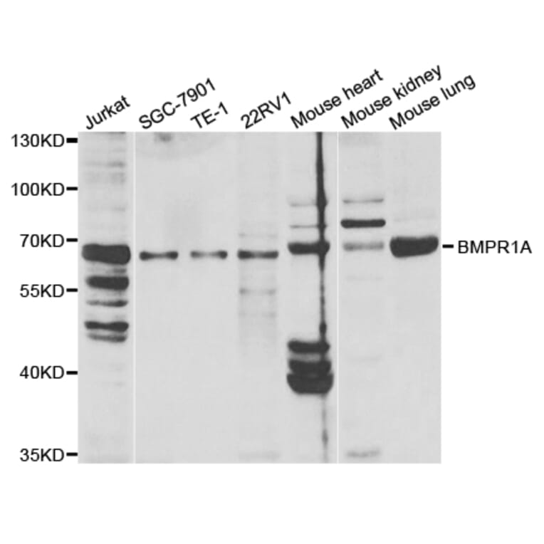 Western blot - BMPR1A Antibody from Signalway Antibody (32447) - Antibodies.com