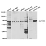 Western blot - BMPR1A Antibody from Signalway Antibody (32447) - Antibodies.com